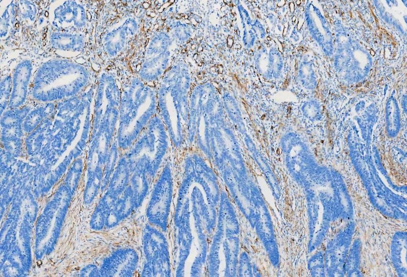 Antigen Retrieval 04